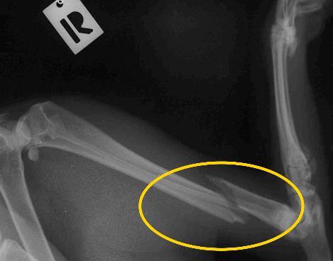 Röntgen Gliedmaße; Fraktur Unterschenkel